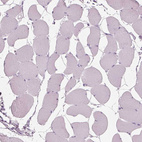 Anti-SLC27A2 Antibody