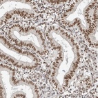 Anti-HNRNPR Antibody