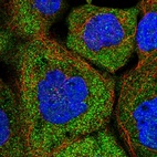 Immunofluorescent staining of human cell line A-431 shows localization to cytosol.