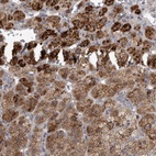 Anti-RAB29 Antibody