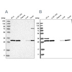 Anti-RPA2 Antibody