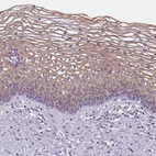 Immunohistochemical staining of human uterine cervix shows weak to moderate cytoplasmic positivity in squamous epithelial cells.