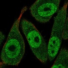 Anti-RAD23A Antibody