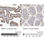 Anti-WDR77 Antibody