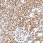 Anti-WDR77 Antibody