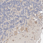 Anti-WDR77 Antibody