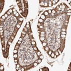 Anti-ARHGEF10L Antibody