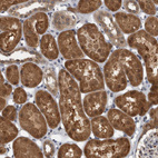 Anti-LMAN2L Antibody