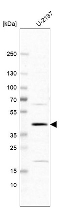 Anti-RBMX2 Antibody