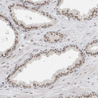 Anti-NCAPG2 Antibody