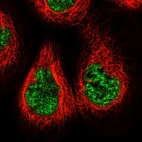 Anti-NCAPG2 Antibody