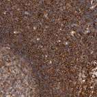 Anti-CCDC88B Antibody