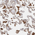 Anti-CCDC88B Antibody