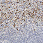 Anti-FGL2 Antibody