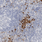 Anti-FGL2 Antibody