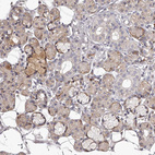 Anti-TNN Antibody