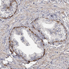 Anti-TNN Antibody