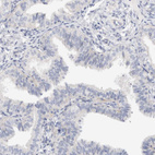 Anti-SPINK2 Antibody