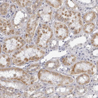 Immunohistochemical staining of human Kidney shows moderate positivity in endoplasmic reticulum in cells in tubules.