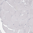 Immunohistochemical staining of human Skeletal muscle shows very weak positivity in endoplasmic reticulum in myocytes.