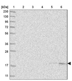 Lane 1: Marker [kDa] 230, 130, 95, 72, 56, 36, 28, 17, 11_br/_Lane 2: Human cell line RT-4_br/_Lane 3: Human cell line U-251MG sp_br/_Lane 4: Human plasma (IgG/HSA depleted)_br/_Lane 5: Human liver tissue_br/_Lane 6: Human tonsil tissue