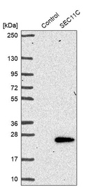 Western blot analysis in control (vector only transfected HEK293T lysate) and SEC11C over-expression lysate (Co-expressed with a C-terminal myc-DDK tag (~3.1 kDa) in mammalian HEK293T cells, LY403241).