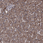 Anti-PCDH17 Antibody