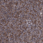 Anti-PCDH17 Antibody