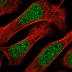 Anti-ZNF613 Antibody