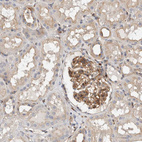 Anti-BNIP2 Antibody