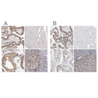 Anti-SMARCC1 Antibody