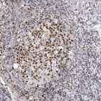 Anti-SMARCC1 Antibody