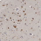 Immunohistochemical staining of human cerebral cortex shows strong cytoplasmic granular positivity in neuronal cells.