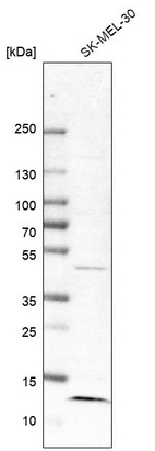 Western blot analysis in human cell line SK-MEL-30.