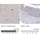 Immunohistochemistry analysis in human cerebral cortex and skin tissues using HPA026888 antibody. Corresponding NCEH1 RNA-seq data are presented for the same tissues.