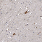 Immunohistochemical staining of human cerebral cortex shows strong cytoplasmic positivity in neuronal cells.