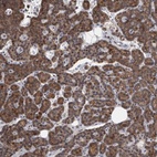 Anti-MAN2A1 Antibody