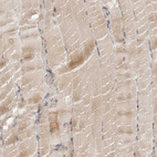 Immunohistochemical staining of human skeletal muscle shows weak cytoplasmic positivity in myocytes.