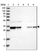 Anti-PDCL3 Antibody