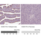 Anti-CCDC170 Antibody