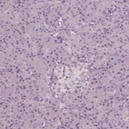 Anti-CCDC170 Antibody