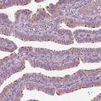 Anti-CCDC170 Antibody