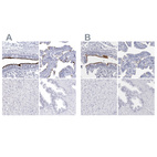 Anti-CCDC181 Antibody