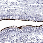 Anti-CCDC181 Antibody