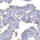 Anti-CCDC181 Antibody