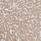 Anti-POLR3GL Antibody