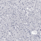 Anti-MYOC Antibody