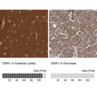 Anti-OXR1 Antibody