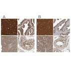 Anti-OXR1 Antibody