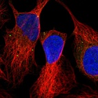 Anti-OXR1 Antibody